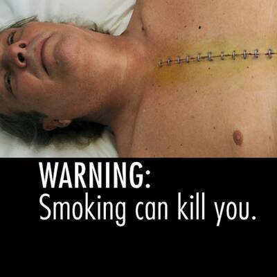Schock-Fotos gegen das Rauchen