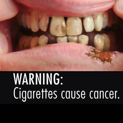 Schock-Fotos gegen das Rauchen