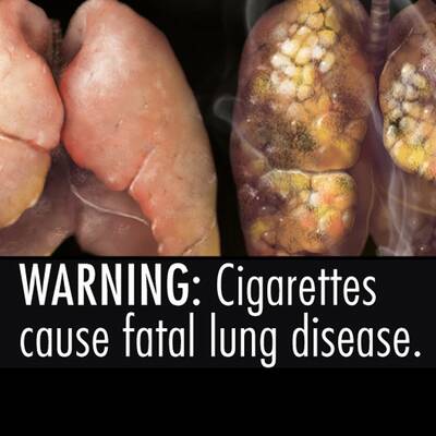 Schock-Fotos gegen das Rauchen