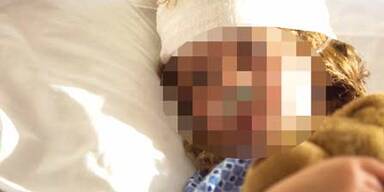 Oma verbrüht Enkerl (3) mit Tee-Wasser