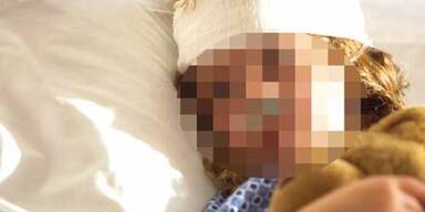 Oma verbrüht Enkerl (3) mit Tee-Wasser