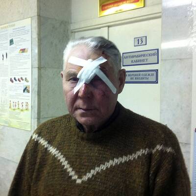 Hunderte Verletzte nach Einschlag