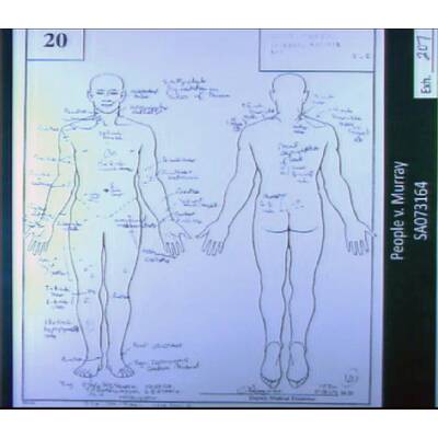 Jackson: Die Schock-Fotos der Anklage