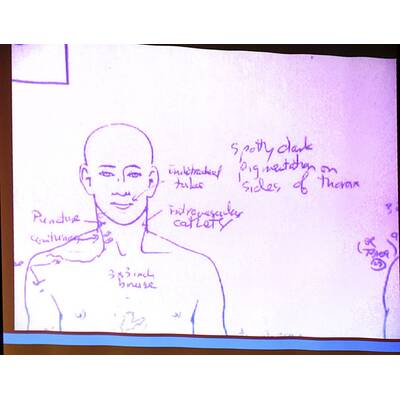 Jackson: Die Schock-Fotos der Anklage