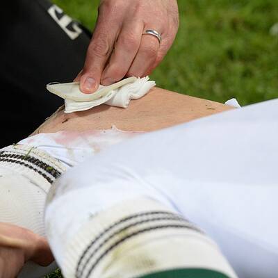 Robbens Knie blutig getreten