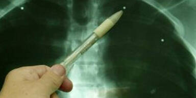 27 Jahre Haft für Handel mit Leichenteilen