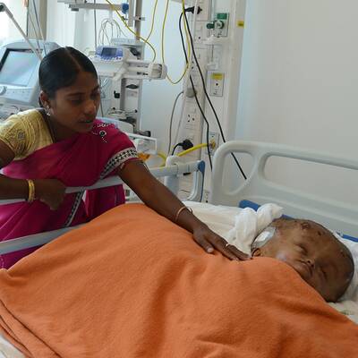 Mädchen mit Wasserkopf operiert