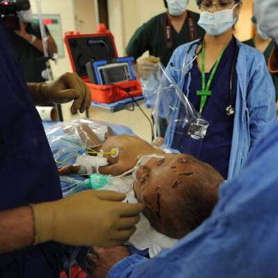 Mädchen mit Wasserkopf operiert