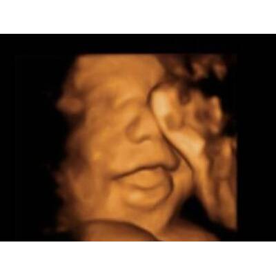 Babys im Bauch: Die witzigsten Bilder