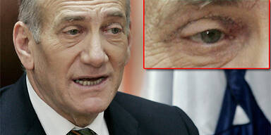 rts_olmert_augenlider