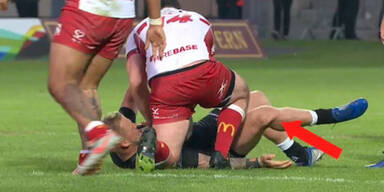 Rugby-Spieler haut sich Kniescheibe selbst wieder rein
