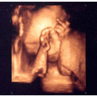 Babys im Bauch: Die witzigsten Bilder