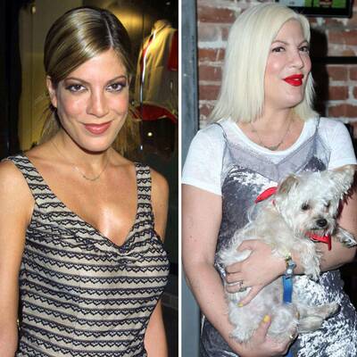 Operationen: Stars vorher und nachher