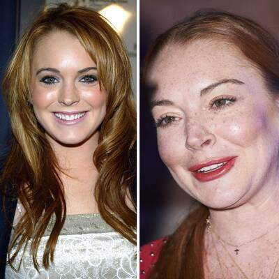 Operationen: Stars vorher und nachher