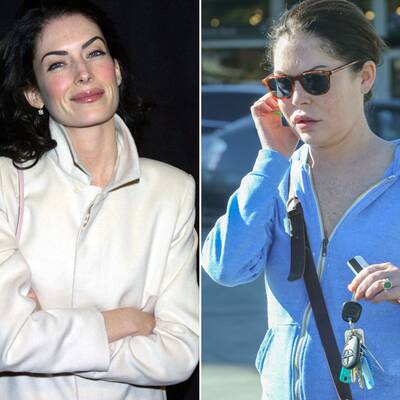 Operationen: Stars vorher und nachher