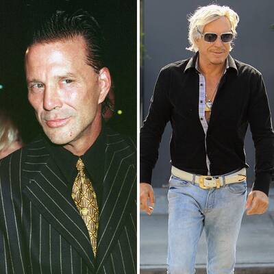 Operationen: Stars vorher und nachher