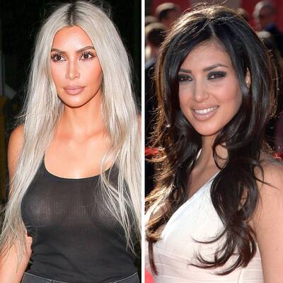 Operationen: Stars vorher und nachher