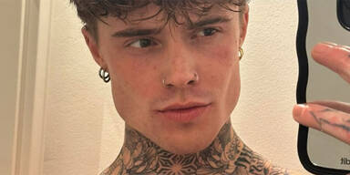 GNTM: Heidi-Model Samuel brutal niedergestochen