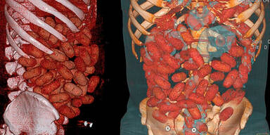 Drogenkurier in Sao Paulo