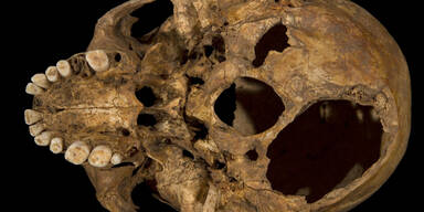 Skelett gehört König Richard III.