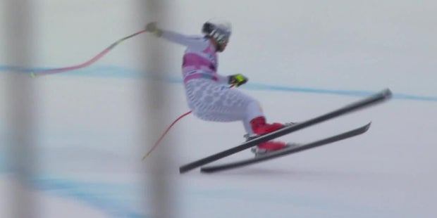 Schock-Diagnose nach Horror-Sturz