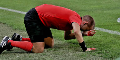 Mega-Skandal: Linienrichter von Becher getroffen