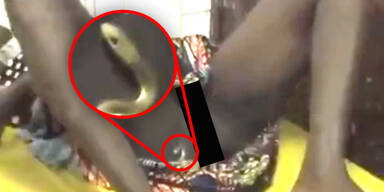 Lebende Schlange in Vagina einer Frau gefunden