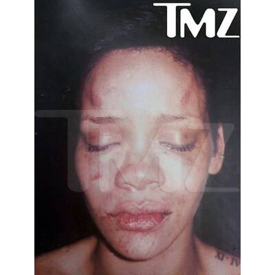 Prügelattacke: Sozialdienst für Chris Brown