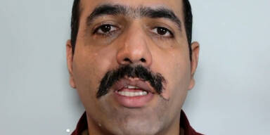 So schmerzhaft geht die Bart-Entfernung