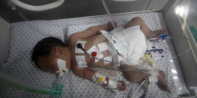 Gaza: Baby aus Leib toter Mutter gerettet