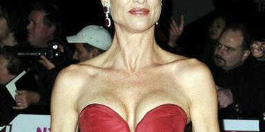 Beauty-Experte Worseg: Sheridans Schönheits-OPs