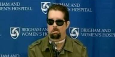 USA: Spektakuläre Gesichtsoperation