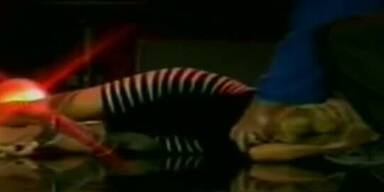 Hunziker verletzt sich bei Supertalent-Show