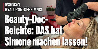 Beauty-Doc-Beichte: DAS hat Simone Lugner jetzt machen lassen!