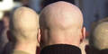 skinhead