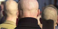 skinhead