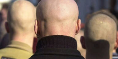 skinhead