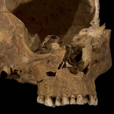 Königliches Skelett