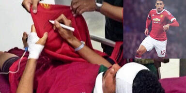 Smalling von Quallen attackiert