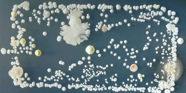 So ekelig sind unsere Smartphones