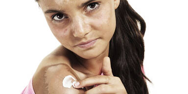 Die 10 größten Gefahren des Sommers