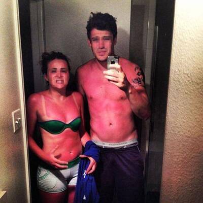 Lustige Sonnenbrände