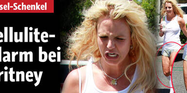 Cellulite: Wem gehören diese Beine?