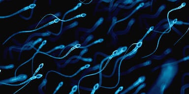 So schaden M&auml;nner unwissentlich ihren Spermien