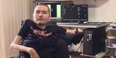 Mann l&auml;sst seinen Kopf transplantieren