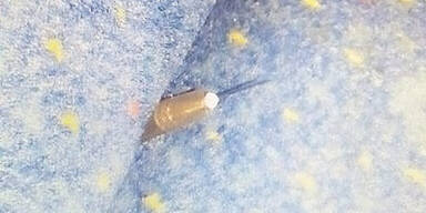 Jetzt hei&szlig;e Spur zu Spritzen-Phantom