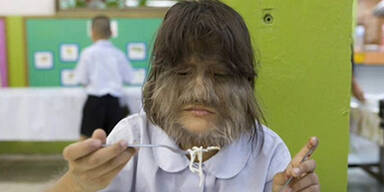 Das behaarteste M&auml;dchen der Welt