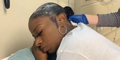 Diese Frau hat den Kopf voller Superkleber &ndash; seit einem Monat