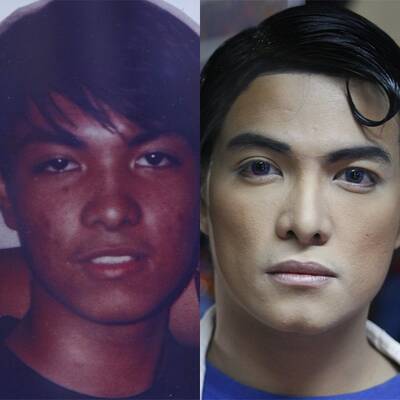 Mann lässt sich zu Superman operieren