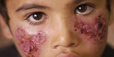 ISIS-Morde l&ouml;sen t&ouml;dliche Seuche aus